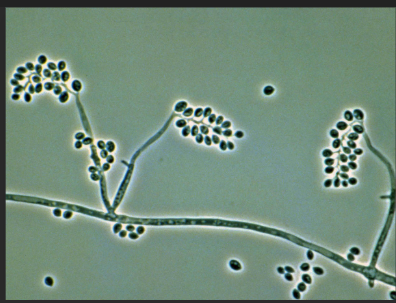 Gambar (b) Mikroskopik Beauveria bassiana